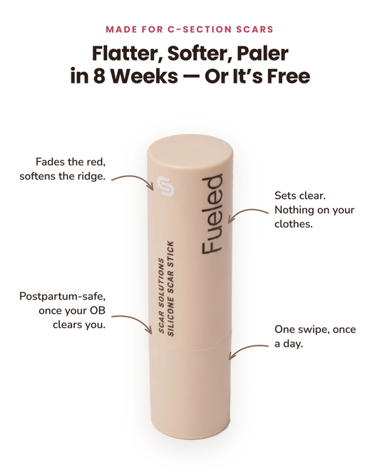 Clinical C-Section Scar Stick