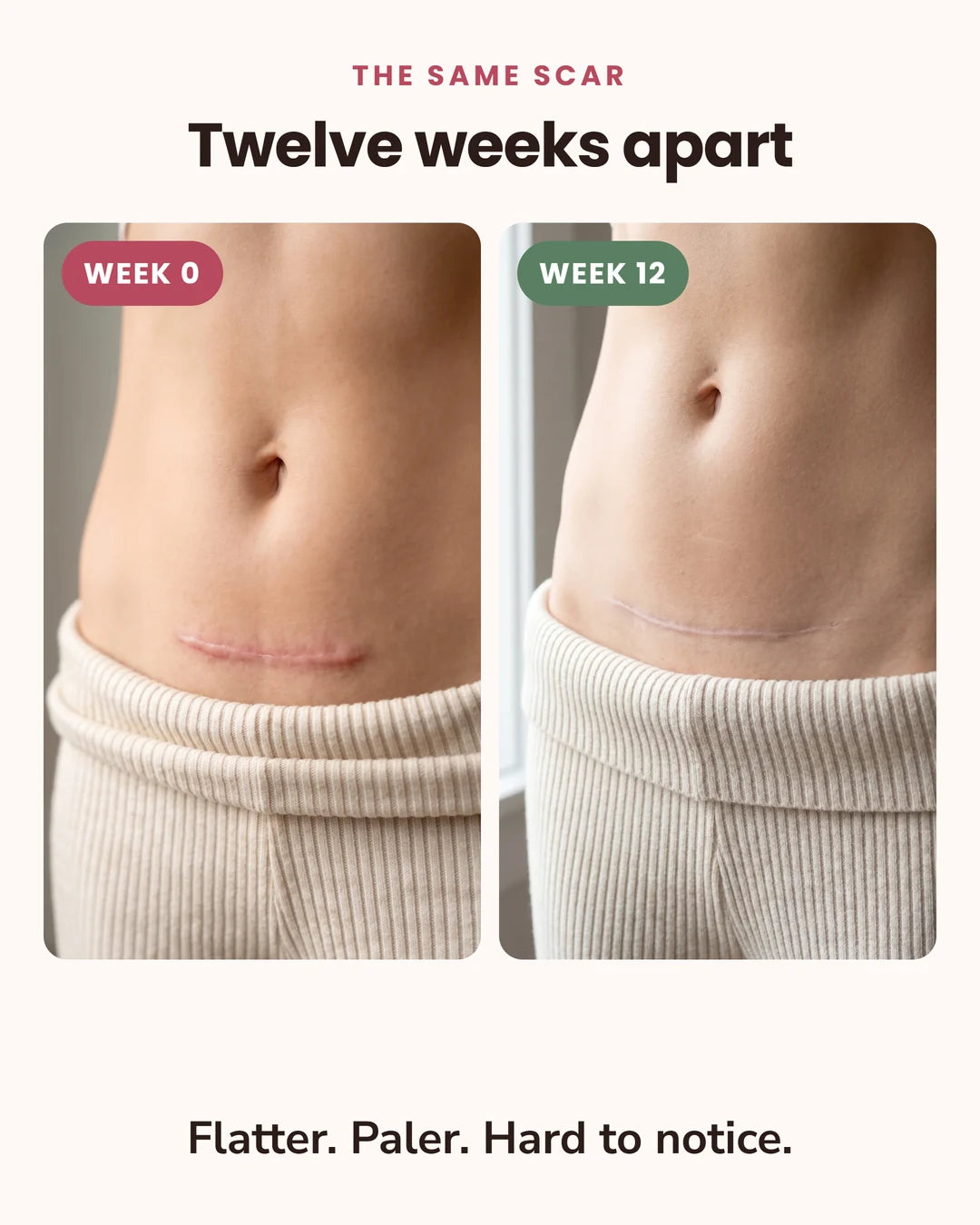 Before and after